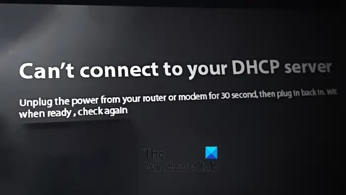 Can’t connect to your DHCP server error on Xbox